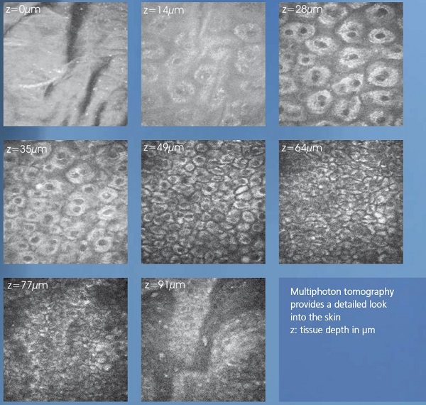 皮肤光学活检系统DermaInspect提供亚细胞分辨率的非侵入性体内皮肤光学活检